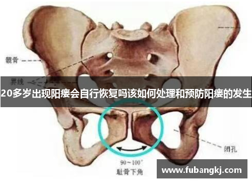 20多岁出现阳瘘会自行恢复吗该如何处理和预防阳瘘的发生